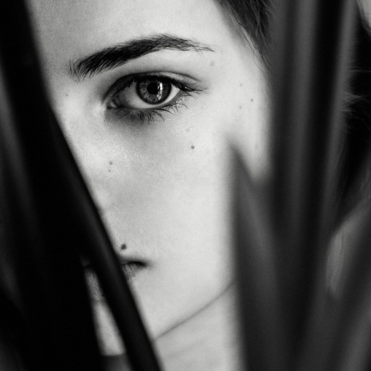 Woman with moles
