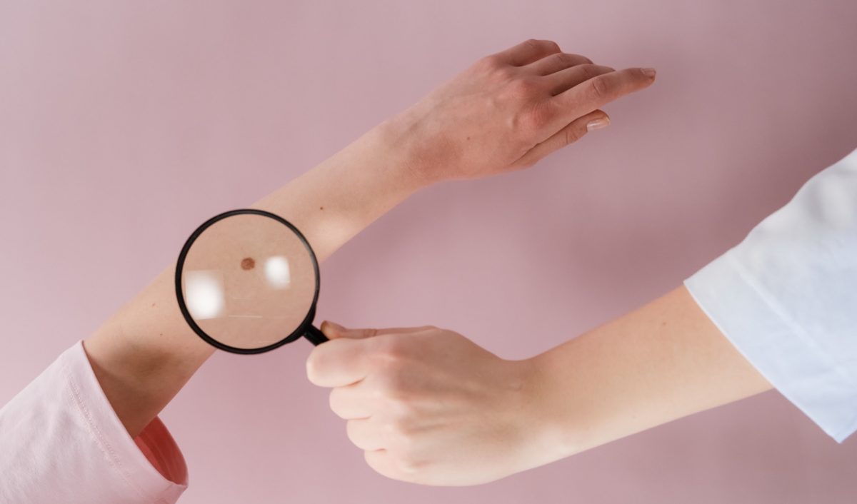 Checking your skin for abnormalities